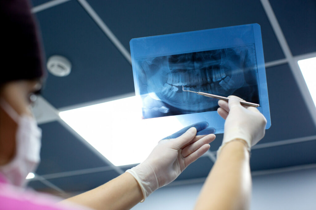 Types of Dental XRays and When They're Needed